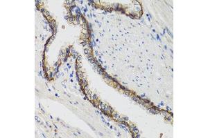 Immunohistochemistry of paraffin-embedded human prostate using  antibody (ABIN1512611, ABIN3021021, ABIN3021022, ABIN1513797 and ABIN6213916) at dilution of 1:100 (40x lens). (ATP1A (AA 551-850) antibody)