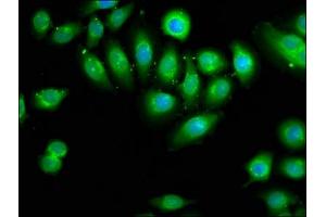 Immunofluorescence staining of A549 cells with ABIN7149579 at 1:66, counter-stained with DAPI. (DOCK1 antibody  (AA 1676-1865))