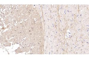 Detection of CDNF in Rat Spinal cord Tissue using Monoclonal Antibody to Cerebral Dopamine Neurotrophic Factor (CDNF) (CDNF antibody  (AA 20-183))