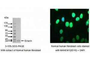 Image no. 1 for anti-Emerin (EMD) (AA 1-188) antibody (ABIN1042591) (Emerin antibody  (AA 1-188))