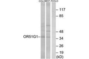 Western blot analysis of extracts from COLO/MCF-7 cells, using OR51G1 Antibody. (OR51G1 antibody  (AA 199-248))