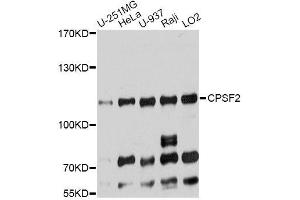 Western blot analysis of extracts of various cell lines, using CPSF2 antibody (ABIN5996261) at 1:7000 dilution. (CPSF2 antibody)