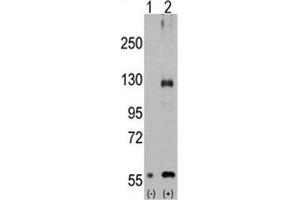 Western blot analysis of TRPM8 antibody and 293 cell lysate either nontransfected (Lane 1) or transiently transfected with the TRPM8 gene (2). (TRPM8 antibody  (AA 521-552))