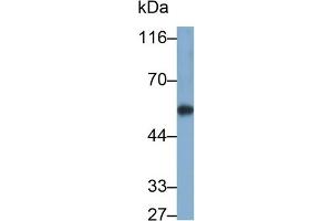 Detection of CYP1A1 in Rat Liver lysate using Polyclonal Antibody to Cytochrome P450 1A1 (CYP1A1) (CYP1A1 antibody  (AA 251-521))