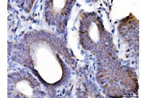 IHC analysis of Cyclin A2 using anti-Cyclin A2 antibody (ABIN3043481). (Cyclin A antibody  (AA 10-168))
