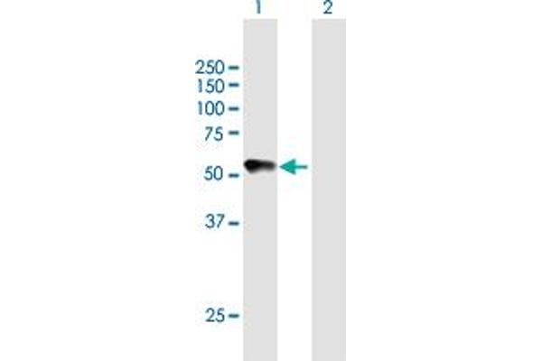 CHRDL2 antibody  (AA 1-451)