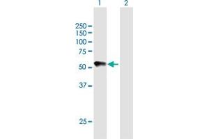 Western Blot analysis of CHRDL2 expression in transfected 293T cell line by CHRDL2 MaxPab polyclonal antibody.