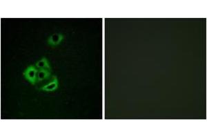 Immunofluorescence analysis of A549 cells, using MCL1 (Phospho-Ser159) Antibody.