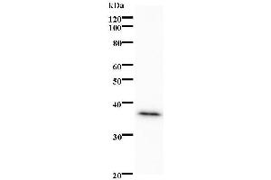 Western Blotting (WB) image for anti-Peroxisome Proliferator-Activated Receptor alpha (PPARA) antibody (ABIN931197) (PPARA antibody)