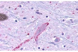 Anti-MRGPRF antibody  ABIN1049074 IHC staining of human brain, neurons and glia. (Mrgprf antibody  (C-Term))