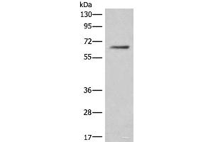 Western blot analysis of Hela cell lysate using CEP57 Polyclonal Antibody at dilution of 1:450 (CEP57 antibody)