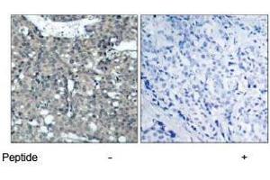 Image no. 1 for anti-Paxillin (PXN) (Tyr118) antibody (ABIN197279) (Paxillin antibody  (Tyr118))