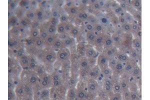 DAB staining on IHC-P; Samples: Mouse Liver Tissue (ITIH4 antibody  (AA 721-942))