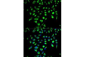 Immunofluorescence analysis of MCF-7 cell using CD86 antibody. (CD86 antibody  (AA 30-247))