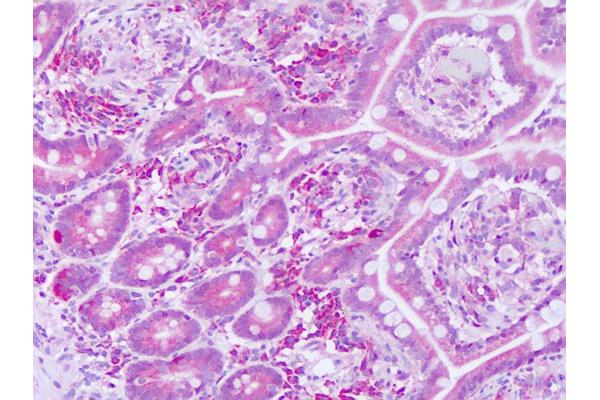 KTI12 antibody  (AA 170-219)