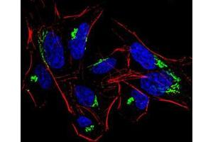 Immunofluorescence analysis of HeLa cells using HDAC4 mouse mAb (green). (HDAC4 antibody  (AA 456-592))