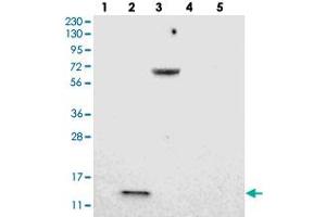 Western blot analysis of Lane 1: RT-4, Lane 2: U-251 MG, Lane 3: Human Plasma, Lane 4: Liver, Lane 5: Tonsil with LOC203547 polyclonal antibody . (VMA21 antibody)