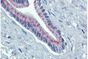 Pancreas, Human: Formalin-Fixed, Paraffin-Embedded (FFPE) (Desmoglein 2 antibody  (AA 72-121))