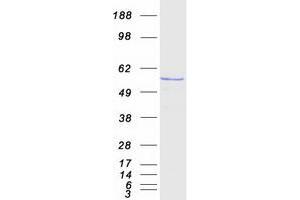 KATNAL1 Protein (Transcript Variant 1) (Myc-DYKDDDDK Tag)