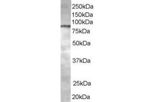 Western Blotting (WB) image for anti-ArfGAP with Coiled-Coil, Ankyrin Repeat and PH Domains 1 (ACAP1) (C-Term) antibody (ABIN2465343) (ACAP1 antibody  (C-Term))
