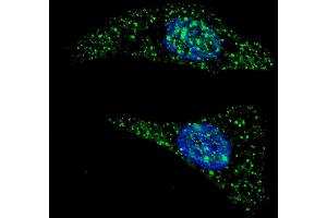 Fluorescent image of  cells stained with ATG5 (N-term) antibody. (ATG5 antibody  (N-Term))