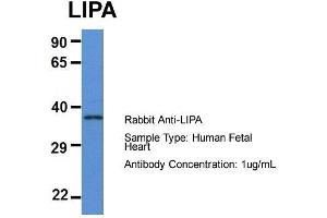 Host: Rabbit  Target Name: LIPA  Sample Tissue: Human Fetal Heart  Antibody Dilution: 1. (Lipase A antibody  (N-Term))