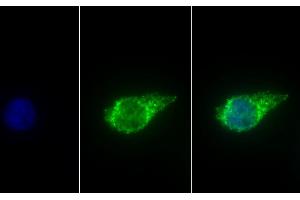 Detection of ALDH1B1 in Human HepG2 cell using Polyclonal Antibody to Aldehyde Dehydrogenase 1 Family, Member B1 (ALDH1B1) (ALDH1B1 antibody  (AA 18-517))