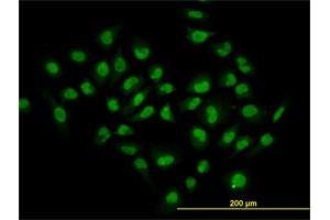 Immunofluorescence of monoclonal antibody to HDAC1 on HeLa cell.