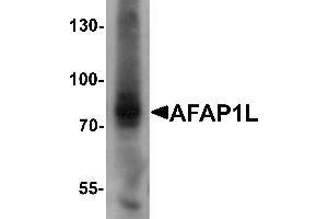 Western blot analysis of AFAP1L1 in A549 cell lysate with AFAP1L1 antibody at 1 µg/mL. (AFAP1L1 antibody  (N-Term))