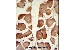 Immunohistochemistry (Paraffin-embedded Sections) (IHC (p)) image for anti-Aspartoacylase (ASPA) (AA 82-110), (N-Term) antibody (ABIN390843)
