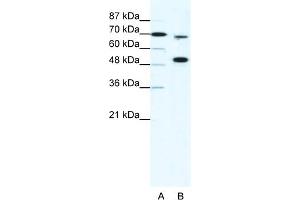 WB Suggested Anti-MLL4 Antibody Titration:  5ug/ml  Positive Control:  HepG2 cell lysate KMT2B is strongly supported by BioGPS gene expression data to be expressed in Human HepG2 cells (MLL4 antibody  (N-Term))