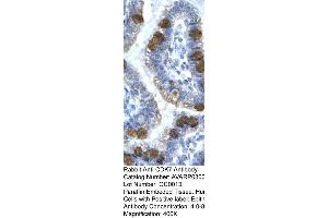 Human Intestine (CDK7 antibody  (C-Term))
