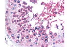 Immunohistochemistry (IHC) image for anti-SWI/SNF Related, Matrix Associated, Actin Dependent Regulator of Chromatin, Subfamily A, Member 4 (SMARCA4) (C-Term) antibody (ABIN2471066) (SMARCA4 antibody  (C-Term))