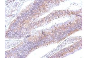 IHC-P Image eEF2 antibody detects eEF2 protein at cytosol on human colon by immunohistochemical analysis. (EEF2 antibody)