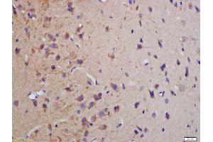 Formalin-fixed and paraffin embedded rat brain labeled with Anti-phospho-MBP(Thr232)Polyclonal Antibody, Unconjugated  at 1:200 followed by conjugation to the secondary antibody and DAB staining (MBP antibody  (pThr232))