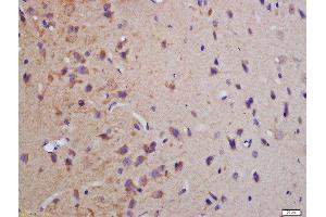 Formalin-fixed and paraffin embedded rat brain labeled with Anti-phospho-MBP(Thr232)Polyclonal Antibody, Unconjugated  at 1:200 followed by conjugation to the secondary antibody and DAB staining