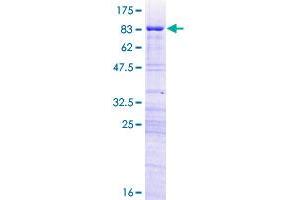 Image no. 1 for Ribosomal RNA Processing 8 (RRP8) (AA 1-456) protein (GST tag) (ABIN1308572)