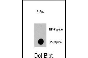 Dot blot analysis of anti-BRAF-p Phospho-specific Pab (ABIN389803 and ABIN2839698) on nitrocellulose membrane.