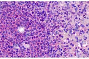 Human Tonsil: Formalin-Fixed, Paraffin-Embedded (FFPE) (CD180 antibody  (N-Term))