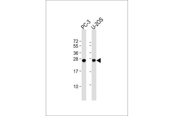 ZCCHC17 antibody  (AA 159-187)
