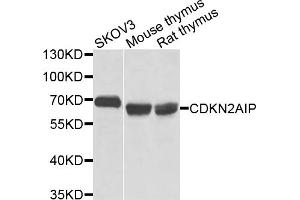 Western blot analysis of extracts of various cell lines, using CDKN2AIP antibody (ABIN5971664) at 1/1000 dilution.