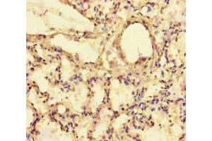 Immunohistochemistry of paraffin-embedded human lung tissue using ABIN7152273 at dilution of 1:100 (Exophilin 5 antibody  (AA 1235-1490))