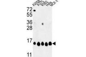 Western Blotting (WB) image for anti-Histone H2A Type 1-H (HIST1H2AH) antibody (ABIN3003926) (HIST1H2AH antibody)
