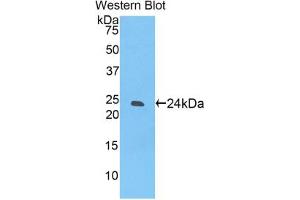 Western blot analysis of the recombinant protein. (SIGLEC12 antibody  (AA 22-218))