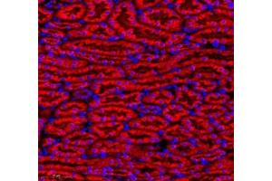 Immunofluorescence of paraffin embedded mouse kidney using MAP7 (ABIN7074621) at dilution of 1:400 (300x lens) (MAP7 antibody)