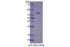 Image no. 1 for Kazal-Type Serine Peptidase Inhibitor Domain 1 (Kazald1) (AA 31-304) protein (His tag) (ABIN6237634) (Kazald1 Protein (AA 31-304) (His tag))