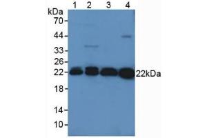 Western blot analysis of (1) Mouse Kidney Tissue, (2) Mouse Liver Tissue, (3) Rat Brain Tissue and (4) Rat Serum. (Peroxiredoxin 2 antibody  (AA 6-164))