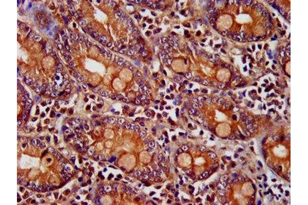PNPLA8 antibody  (AA 158-345)