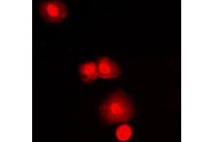 Immunofluorescent analysis of mTOR staining in MCF7 cells.