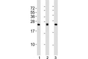 Western blot testing of FGF2 antibody at 1:2000 dilution; Lane 1: human A549 lysate, 2: mouse heart lysate; 3: rat lung lysate (FGF2 antibody)